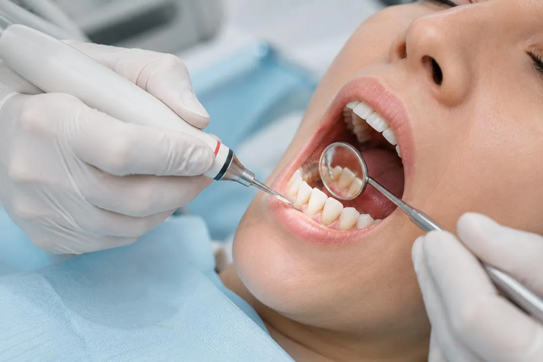Scaling and polishing treatment at Klinik Pergigian Genting, Setapak